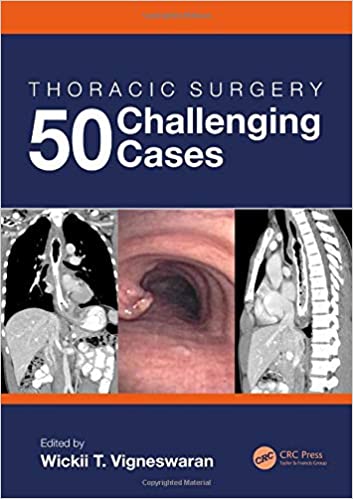 Book - Thoracic Surgery 50 Challenging Cases edited by Doctor Wickii T. Vigneswaran